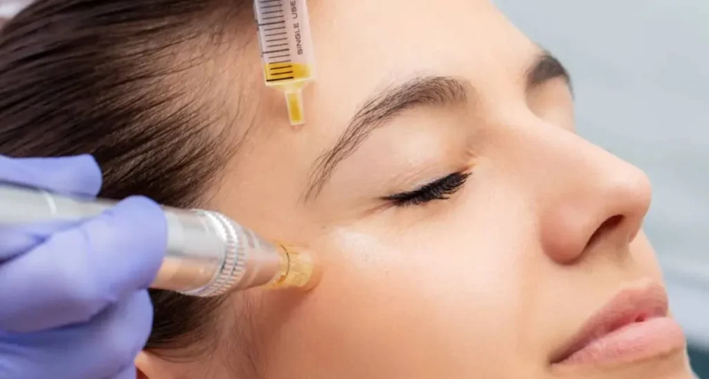 ماندگاری پی آر پی صورت چقدر است؟