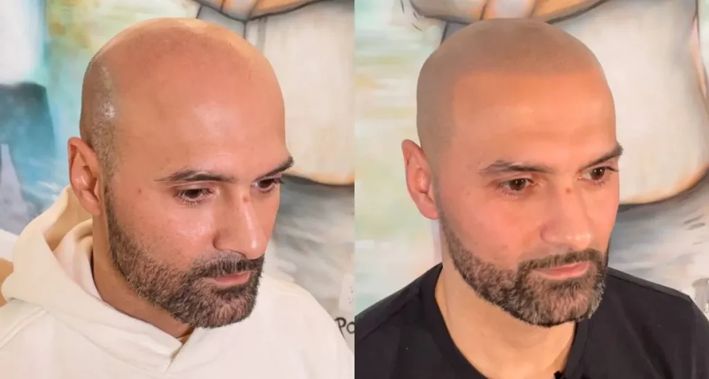 مزایای اسکالپ سر