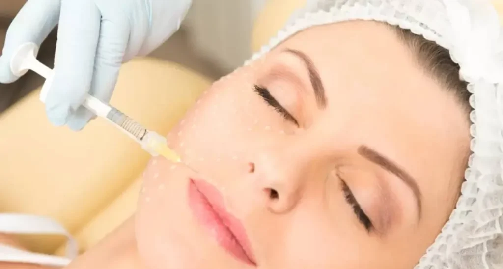 مقایسه روشهای پی آر پی و مزوتراپی صورت