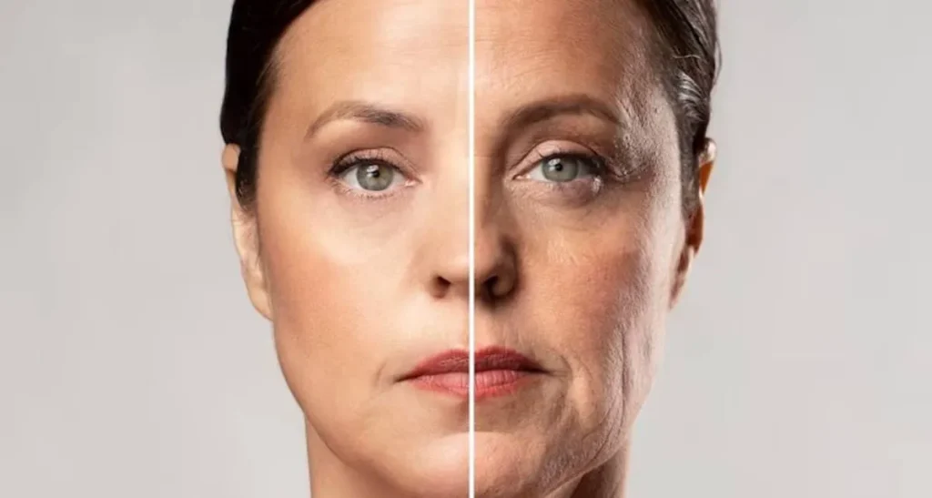 مقایسه مزوتراپی و پی آر پی صورت