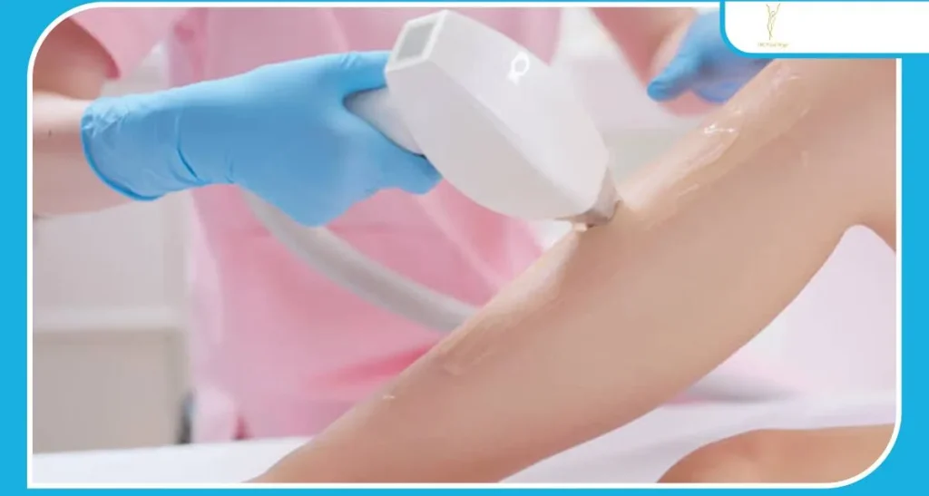 بهترین کرم برای جای سوختگی لیزر