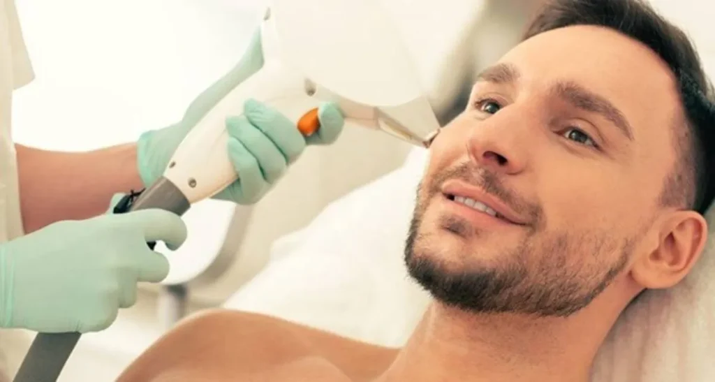 هزینه لیزر موهای زائد مردان