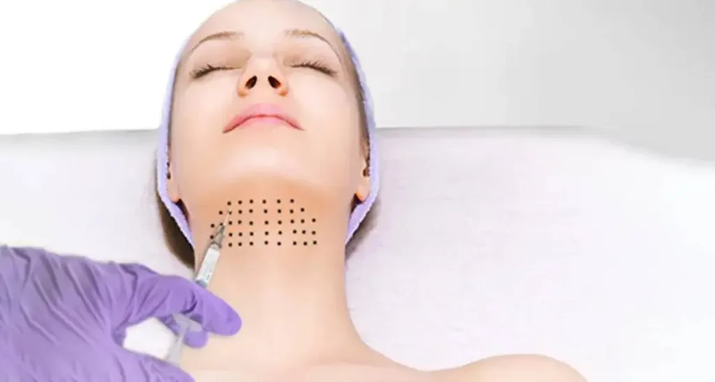 هزینه مزوتراپی غبغب و قیمت مزوتراپی غبغب