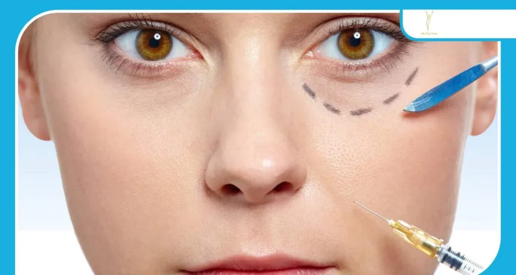 بوتاکس برای گودی زیر چشم