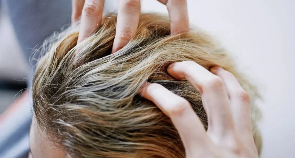 کاشت مو در زنان چه سنی بهتر است؟