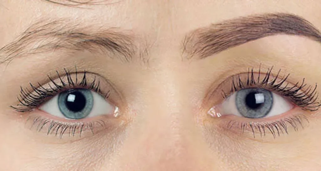 کاندیدای مناسب برای کاشت ابرو