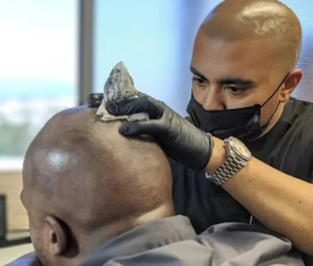 اسکالپ مو چیست؟