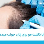 آیا کاشت مو برای زنان جواب میده