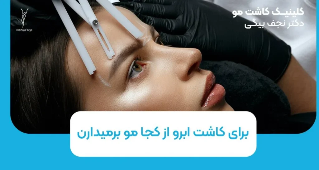 برای کاشت ابرو از کجا مو برداشته می شود؟