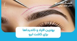 بهترین افراد و کاندیداها برای کاشت ابرو