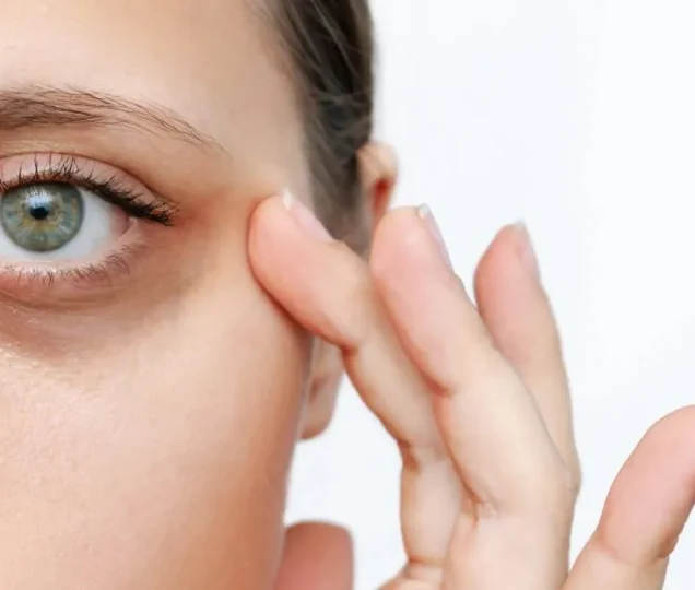 بهترین درمان سیاهی دور چشم