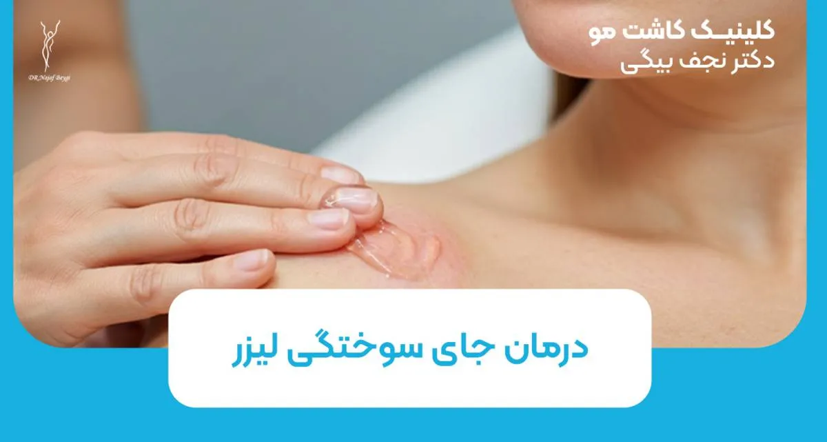 درمان جای سوختگی لیزر و لک ناشی از آن