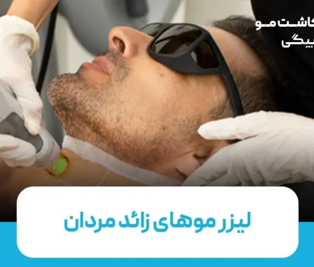 لیزر موهای زائد در مردان؛ هر آنچه باید بدانید
