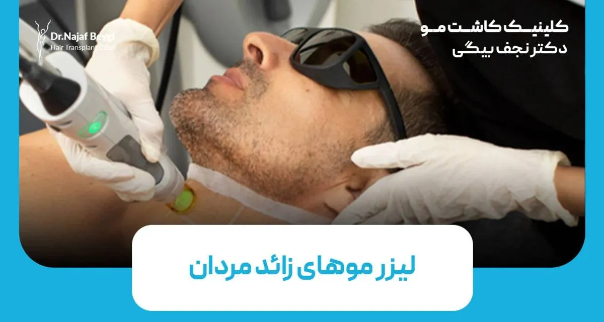 لیزر موهای زائد در مردان؛ هر آنچه باید بدانید  