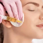 ماندگاری PRP صورت چقدر است؟