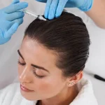 پی آر پی مو بهتره یا مزوتراپی