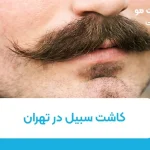 کاشت سبیل در تهران