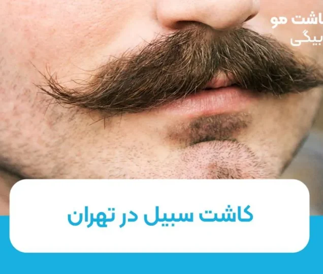 کاشت سبیل در تهران