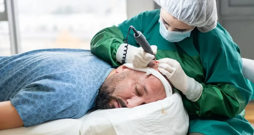 شرایط انتخاب دکتر کاشت مو در تهران