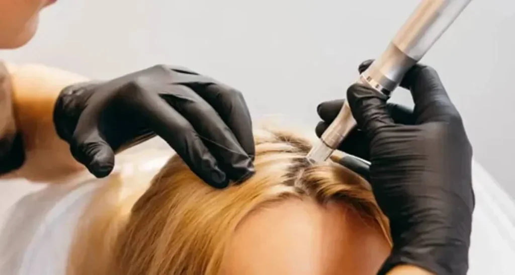 مزونیدلینگ مو سر