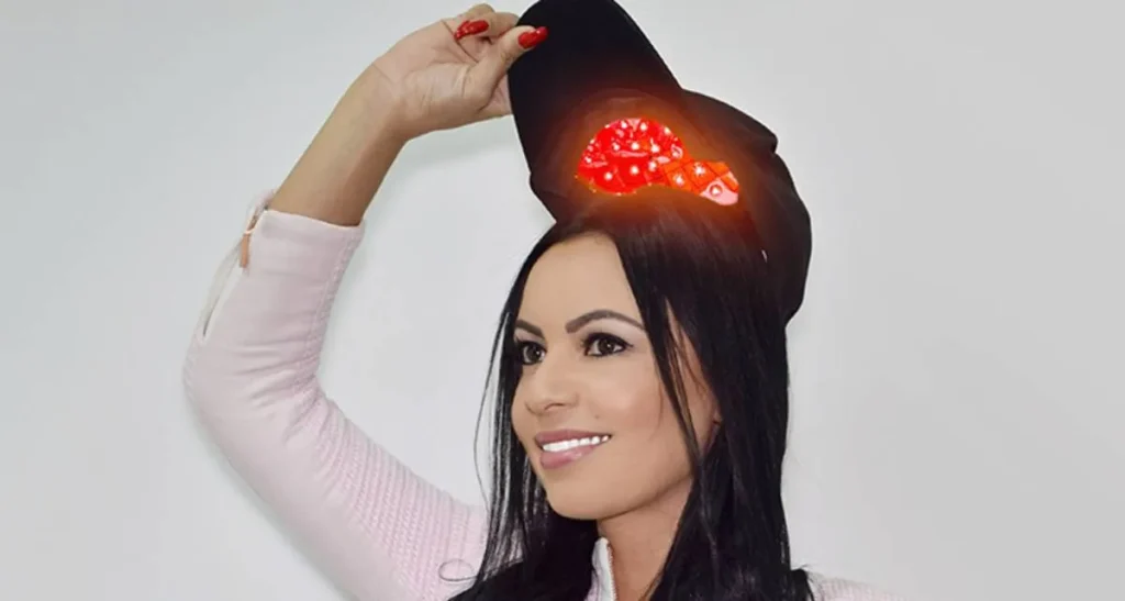 کاشت مو با لیزر در تهران