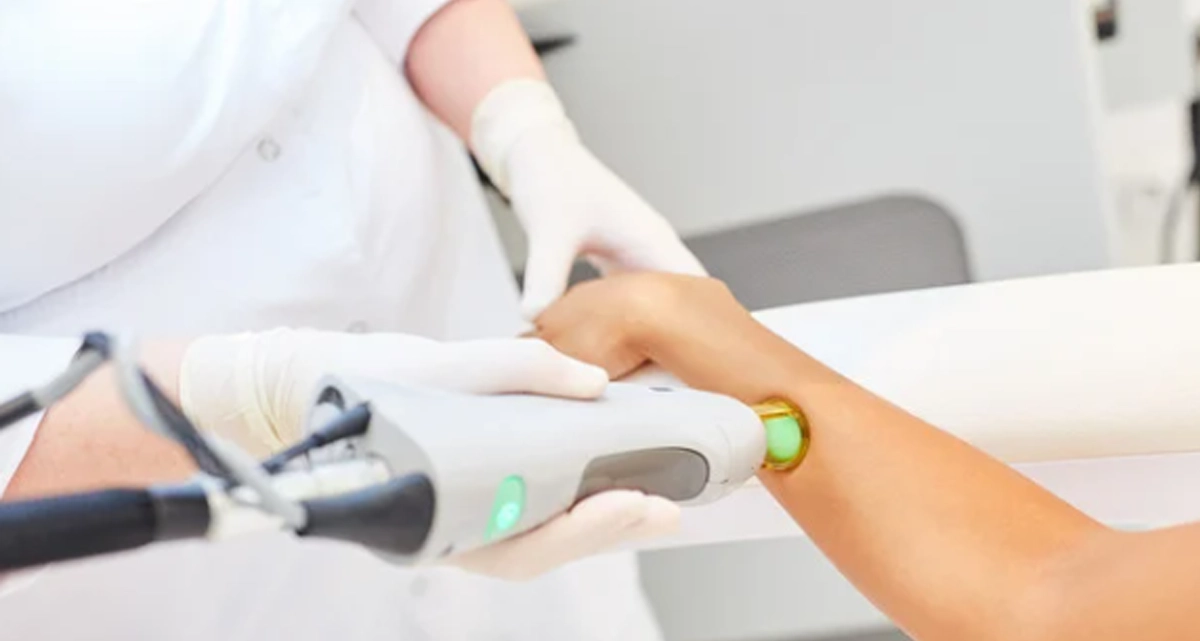 لیزر موی زیربغل