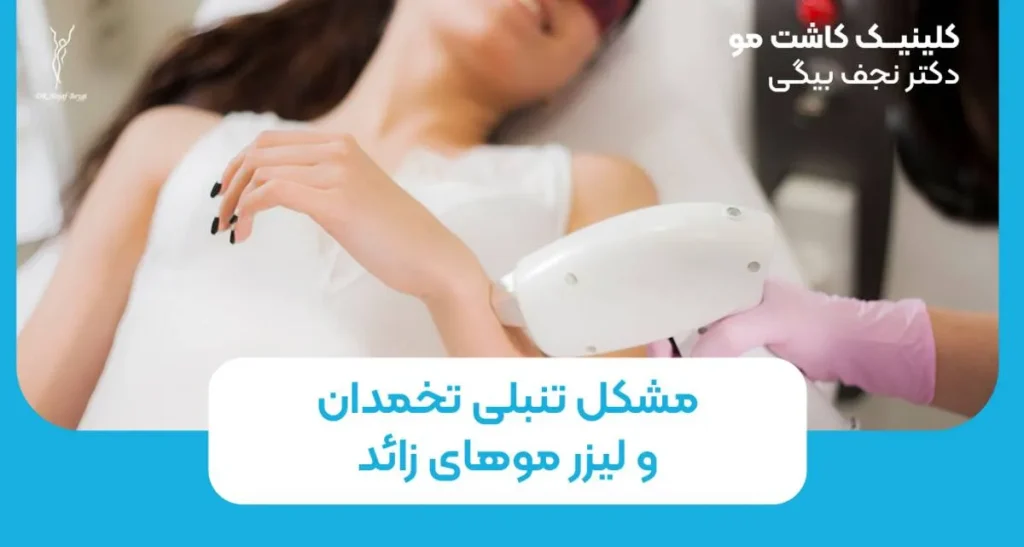 مشکل تنبلی تخمدان و لیزر موهای زائد؛ از واقعیت تا شایعه