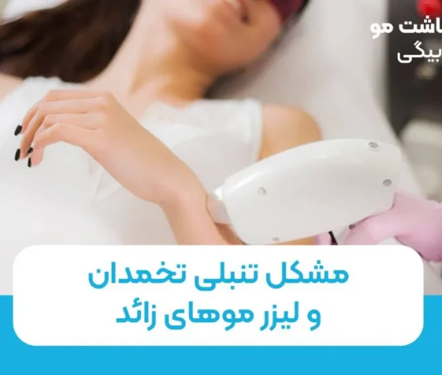 مشکل تنبلی تخمدان و لیزر موهای زائد