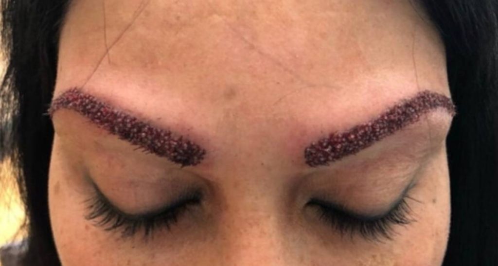 دلایل ایجاد جوش ابرو بعد از کاشت ابرو