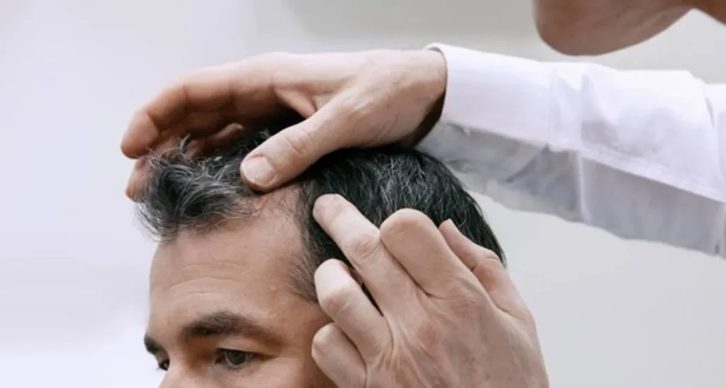 رابطه کاشت مو و بارداری