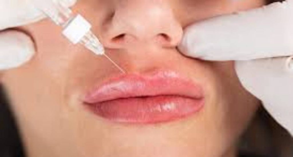 مراقبت بعد از تزریق ژل لب شامل چه نکاتی است