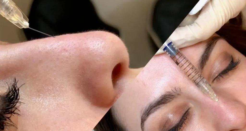 نقش مهارت پزشک در کاهش خطرات تزریق فیلر بینی