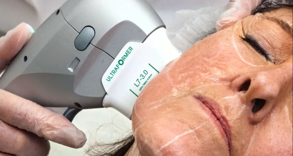 چه افرادی به بیش از یک جلسه هایفو نیاز دارند؟