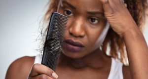 همه چیز درباره الگوهای ریزش مو و انواع آن