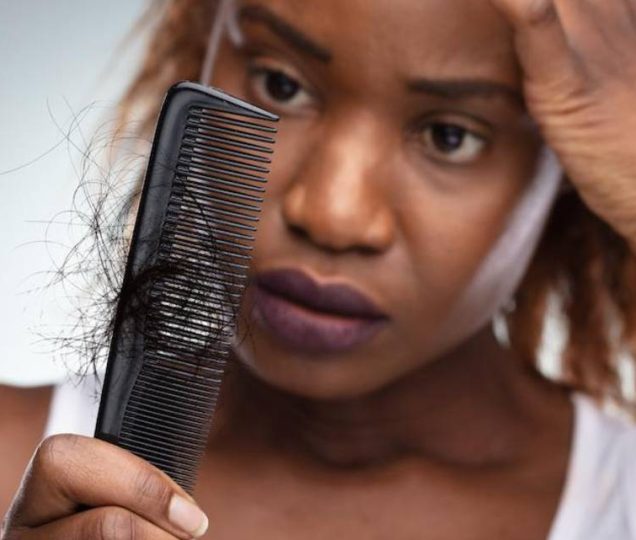 همه چیز درباره الگوهای ریزش مو و انواع آن