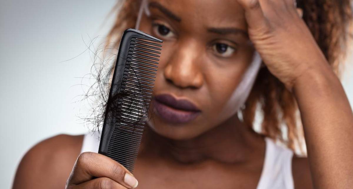 همه چیز درباره الگوهای ریزش مو و انواع آن