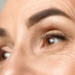 راه های از بین بردن چروک زیر چشم