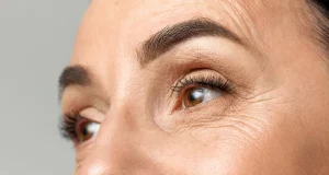 راه های از بین بردن چروک زیر چشم