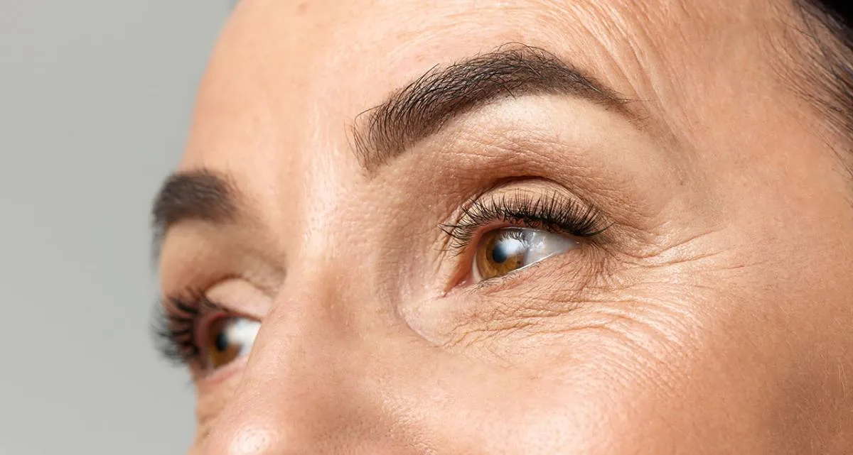 راه های از بین بردن چروک زیر چشم