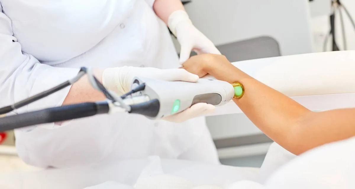 طول دوره درمان و تعداد جلسات لیزر موهای زائد