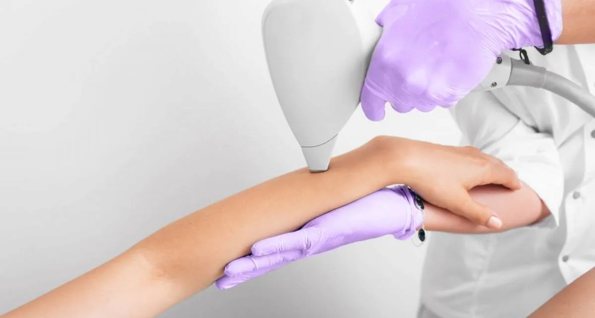 لیزر موهای زائد دست برای چه کسانی بهترین گزینه است؟