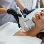 ماندگاری هایفو صورت چقدر است؟