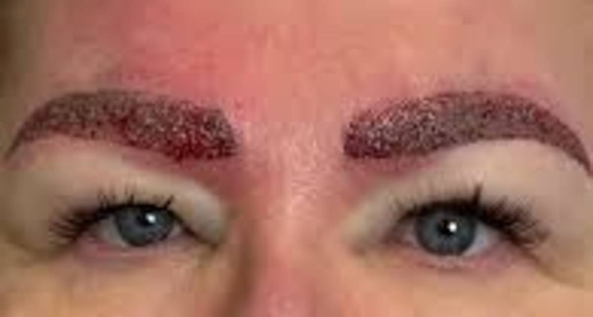 چرا بعد از کاشت ابرو جوش میزند؟