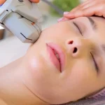 چند بار میتوان هایفو انجام داد