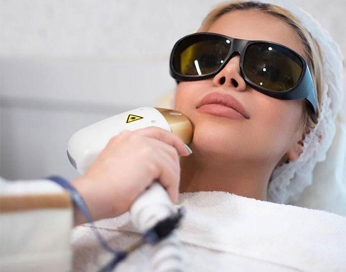 لیزر موهای زائد در افراد با پوست حساس