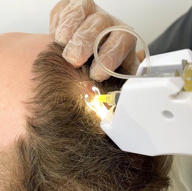 بهترین کلینیک مزوتراپی در سعادت آباد