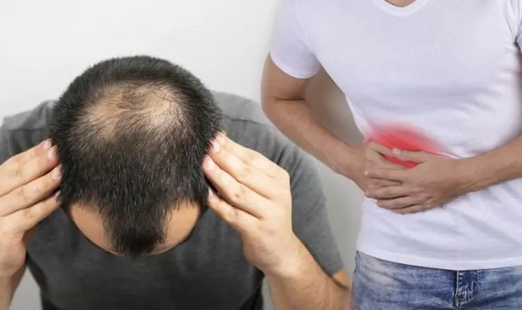 ارتباط ریزش مو و کبد چرب