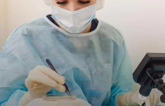 کاشت مو بعد از جراحی بینی