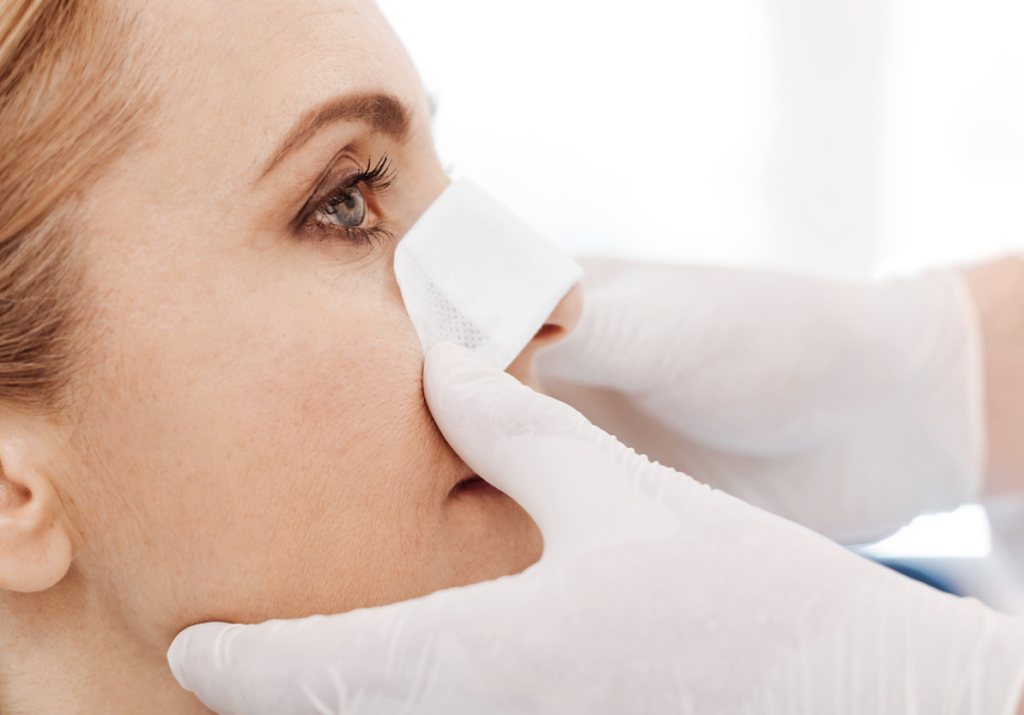 کاشت مو بعد از جراحی بینی