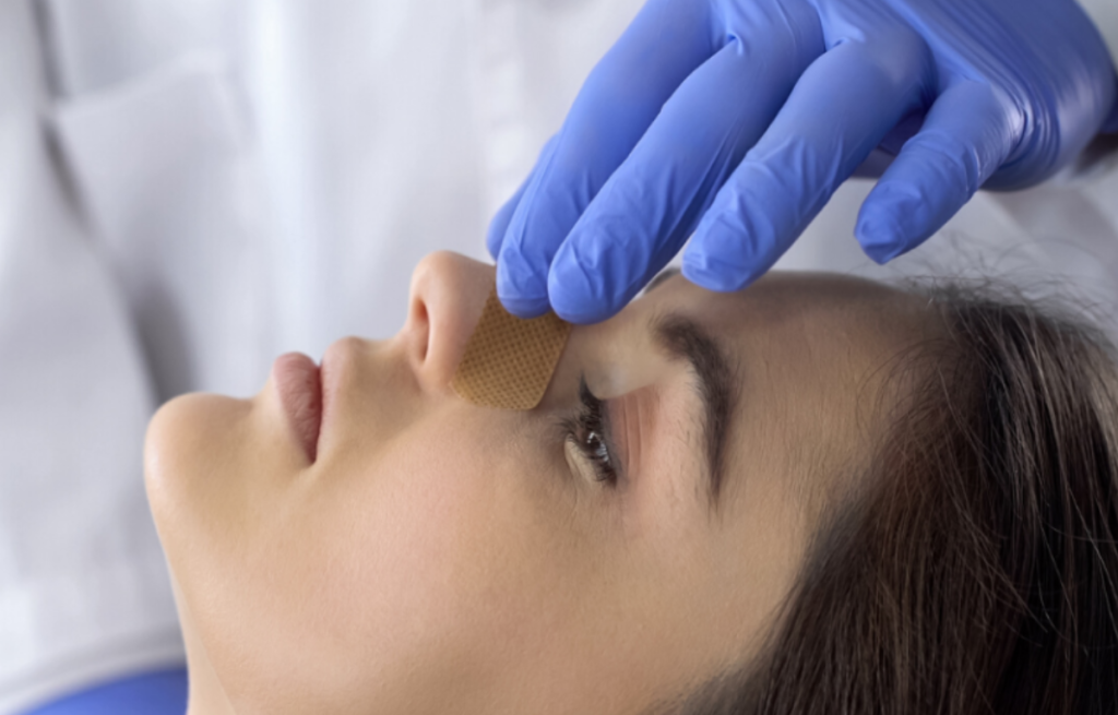 کاشت مو بعد از جراحی بینی